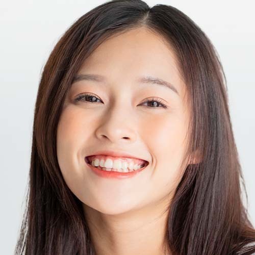 20代向け矯正歯科治療について解説したページへのリンク